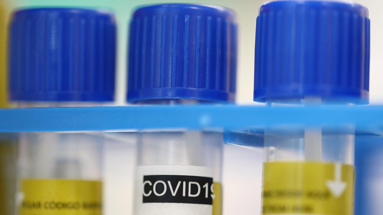 Des tubes de test du coronavirus au laboratoire de microbiologie du CHUV à Lausanne. [Keystone/Reuters Pool - Denis Balibouse]