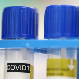 Des tubes de test du coronavirus au laboratoire de microbiologie du CHUV à Lausanne. [Keystone/Reuters Pool - Denis Balibouse]