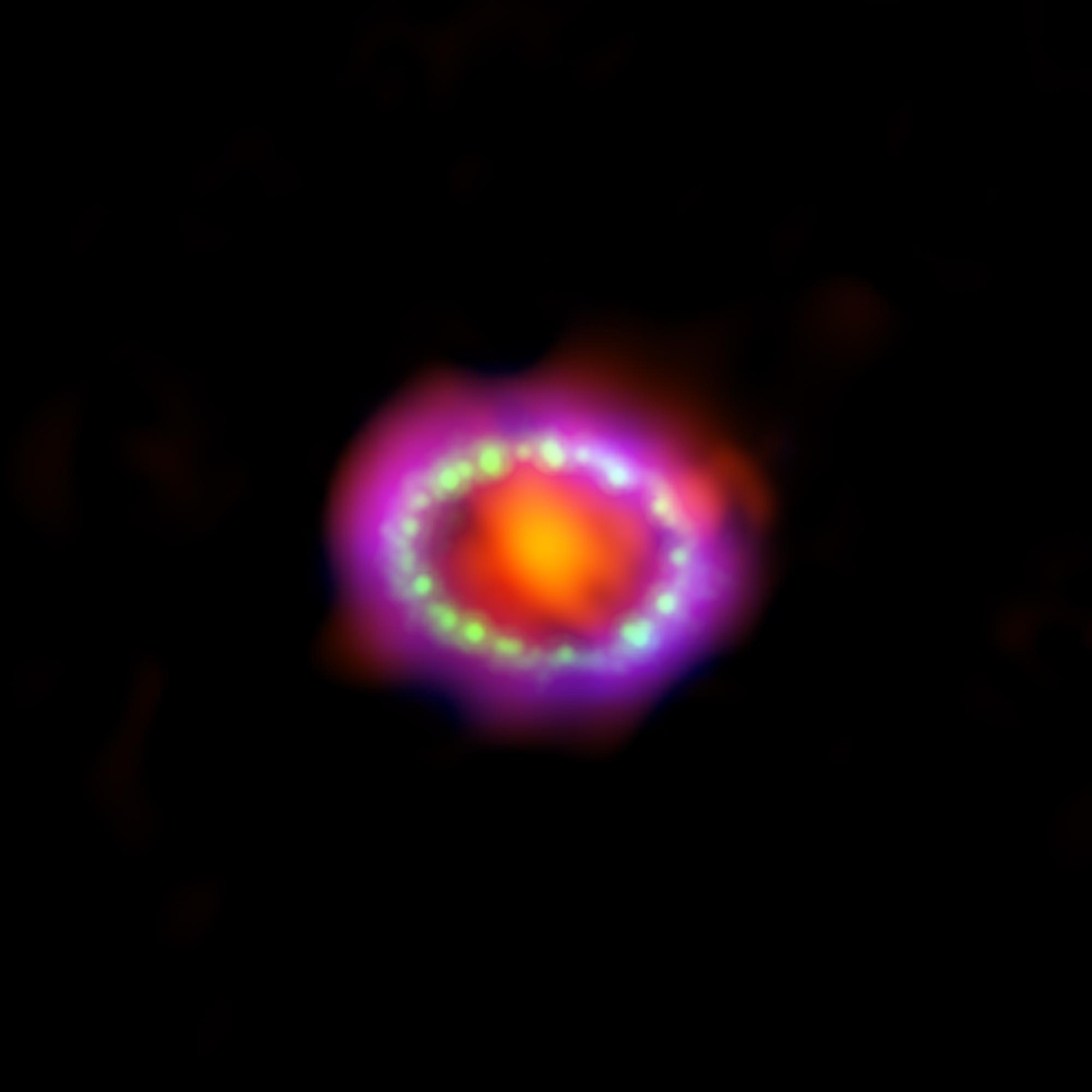 1987A est la première explosion de supernova observée à l'œil nu durant le XXe siècle. Les premières observations du phénomène localisé dans le Grand Nuage de Magellan ont été faites quelques heures à peine après que son éclat eut atteint la Terre, dans la nuit du 23 février 1987, dans l'hémisphère sud. [Millimeter: ESO/NAOJ/NRAO/ALMA - X-ray: NASA/CXC/SAO/PSU/K.Frank et al.; Optical: NASA/STScI]