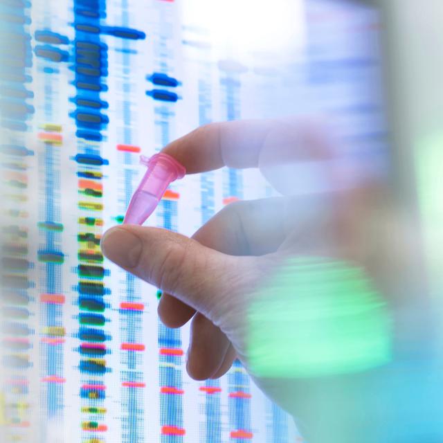 Les tests ADN remportent un grand succès et permettent désormais à chacun et chacune d'obtenir des informations sur ses origines. [AFP - Tek Image / Science Photo Library]