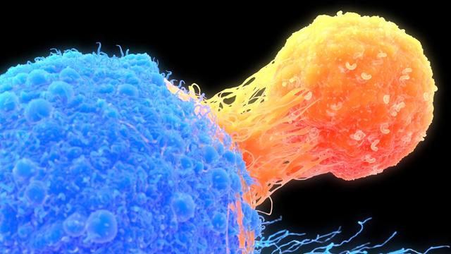 Un lymphocyte T (orange) attaché à une cellule cancéreuse (en bleu). [Science Photo Library via AFP - Roger Harris]