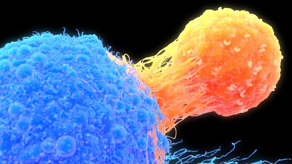 Un lymphocyte T (orange) attaché à une cellule cancéreuse (en bleu). [Science Photo Library via AFP - Roger Harris]