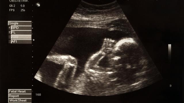 Au cours des neuf mois de grossesse, lʹutérus décuple de volume pour accueillir le fœtus. [Depositphotos - mikdam]