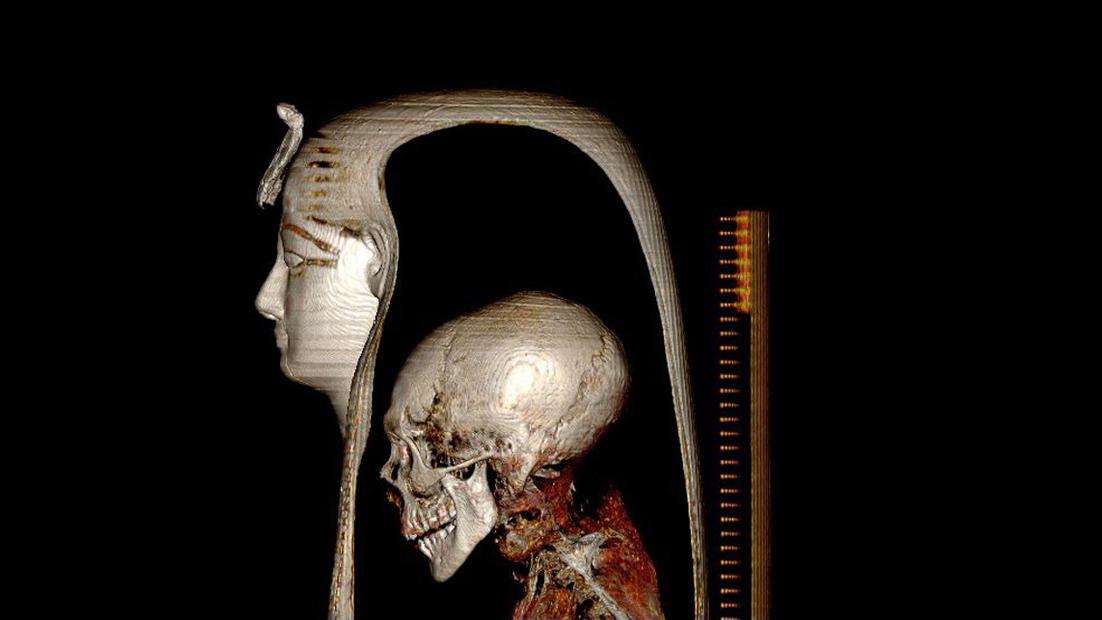Image du crâne d'Amenhotep 1er sous son masque funéraire. [AFP - Egyptian Ministery of Antiquities]