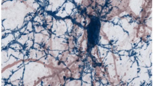 Image microscopique du cerveau d'une souris montrant une telle interaction pouvant devenir destructrice dans la sclérose en plaques.
Img avec CP Unige
Thomas Misgeld 
Unige [Unige - Thomas Misgeld]