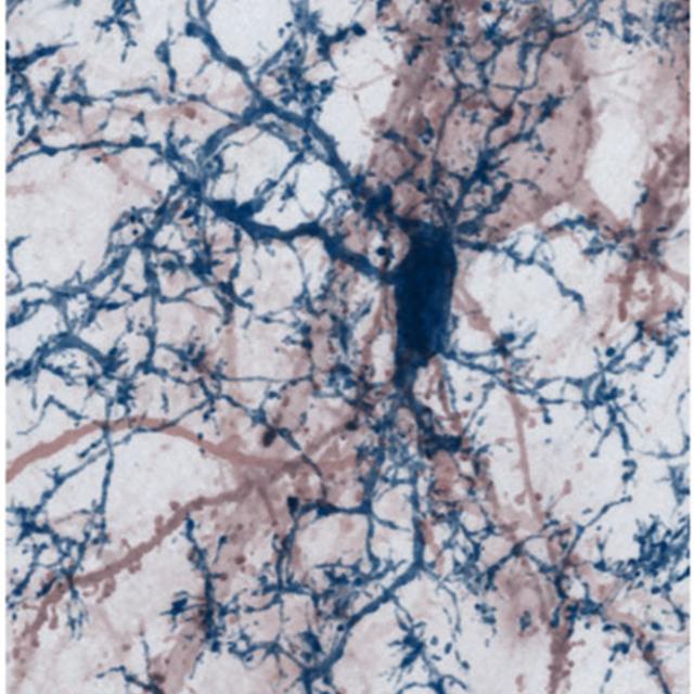 Image microscopique du cerveau d'une souris montrant une telle interaction pouvant devenir destructrice dans la sclérose en plaques.
Img avec CP Unige
Thomas Misgeld 
Unige [Unige - Thomas Misgeld]