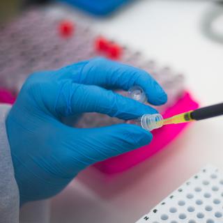 Tests biologiques au laboratoire parisiens Eylau UNlLABS.
Nathan Laine/Hans Lucas 
AFP [Nathan Laine/Hans Lucas]