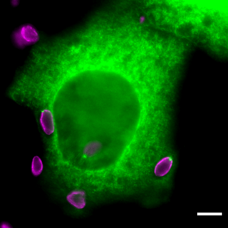 En vert, une cellule humaine infectée par des parasites Toxoplasma gondii (en violet).
Dominique Soldati-Favre
Unige [Dominique Soldati-Favre]