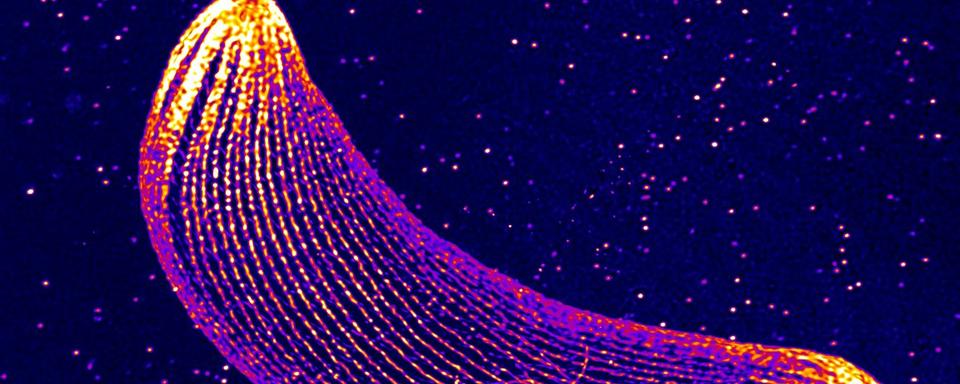 Plasmodium au stade oocinète observe par microscopie à expansion.
Virginie Hamel 
UNIGE [Virginie Hamel]