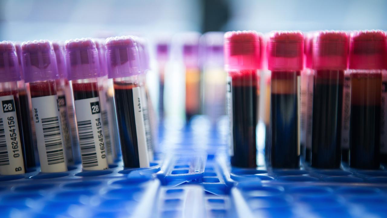 Une équipe de l'Empa et de l'hôpital cantonal de St-Gall est en train de développer un test sanguin qui devrait permettre de détecter plus simplement et précocement la maladie d'Alzheimer. Les chercheurs utilisent la microscopie à force atomique (ATM). [KEYSTONE - SEBASTIAN GOLLNOW]