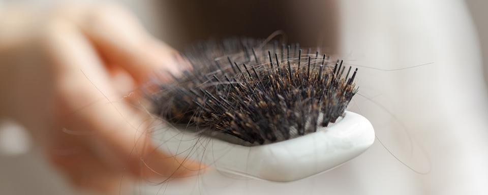 C’est essentiellement l’alopécie androgénétique qui est la cause de la perte de cheveux chez les femmes.
Fotofabrika
Depositphotos [Fotofabrika]