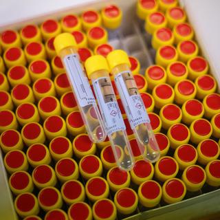 Les tests PCR achetés par la Suisse pour constituer sa réserve n'ont été que peu utilisés par les laboratoires. [AFP/Yomiuri Shinbun - Kunihiko Miura]