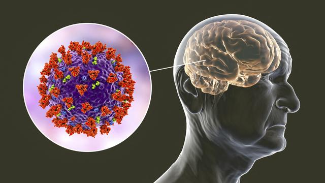 Une nouvelle étude publiée dans Nature atteste que le Covid-19 s'en prend également au cerveau (image d'illustration). [AFP - Kateryna Kon]