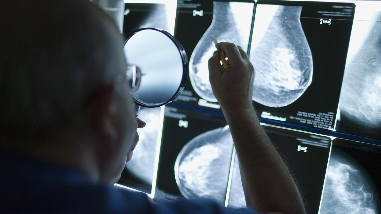 Un radiologiste examine les images d'une mammographie, pour détecter un possible cancer du sein. [Keystone - Gaetan Bally]