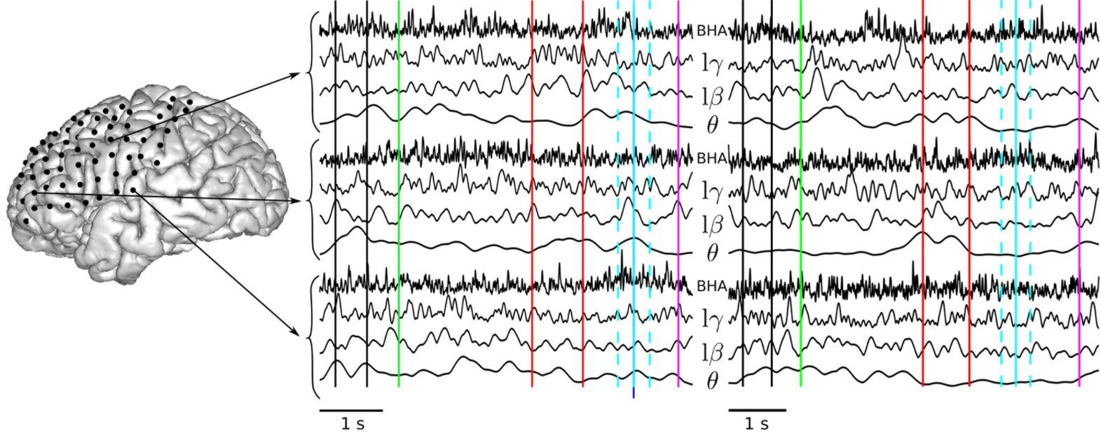 Le langage prononcé (à gauche), comparé au langage imaginé (à droite), sur quatre bandes de fréquences. Les lignes verticales indiquent les événements temporels pertinents de l'étude: période de base (entre les lignes noires), apparition du mot à l'écran (vert), indices auditifs (rouge), temps de parole attendu (bleu clair), temps de parole réel (bleu foncé), fenêtre d'analyse (bleu pointillé clair) et réponse manuelle (violet). [Nature Communications - Thimothée Proix et al.]