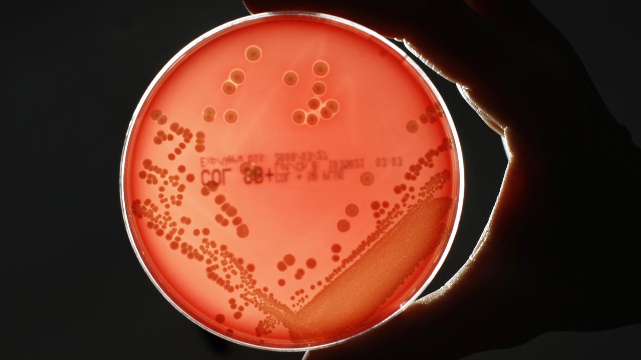 Le staphylocoque doré figure parmi les bactéries les plus meurtrières dans une étude montrant que les infections d'origine bactérienne sont la deuxième cause de décès dans le monde. [Fabrizio Bensch]