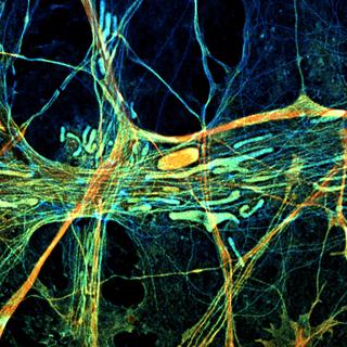 Un neurone avec ses mitochondries, petits organites intracellulaires considérés comme les "usines énergétiques" de la cellule.
Jean-Claude Martinou
Unige [Unige - Jean-Claude Martinou]
