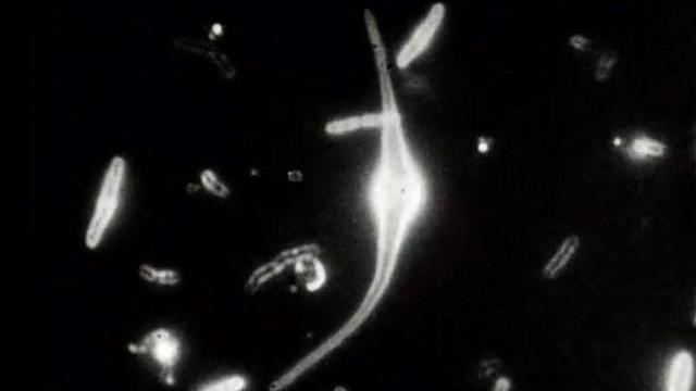 Bacilles de Koch vus au microscope, 1961. [RTS]