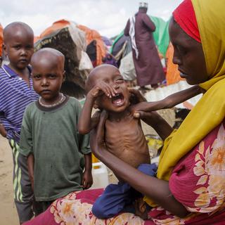 La malnutrition en Somalie touche tout particulièrement les enfants de moins de cinq ans. [AP/Keystone - Farah Abdi Warsameh]