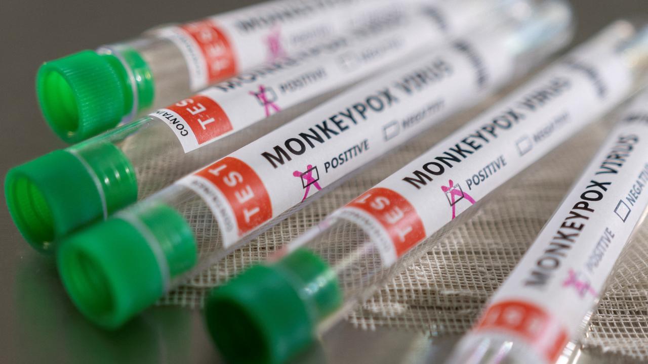 Des tests positifs à la variole du singe. [Reuters - Dado Ruvic]