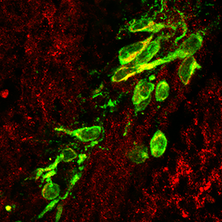Certains neurones à GnRH (vert) expriment la NOS1 (rouge) au cours de leur migration du nez vers le cerveau pendant la vie fœtale. Les cellules doublement marquées GnRH + NOS1 apparaissent en jaune. 
Vincent Prévot
Inserm [Vincent Prévot]