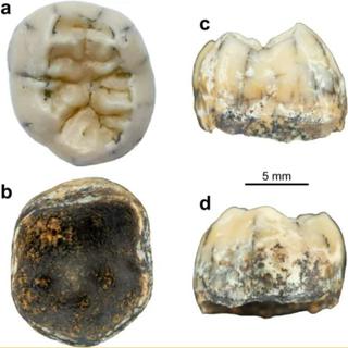 La molaire d'une fillette de Denisova du milieu du Pleistocène, trouvée dans le nord du Laos. Spécimen nommé TNH2-1.
