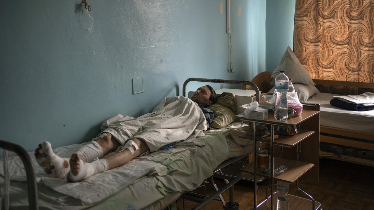 Civil blessé à l'hôpital de Brovary, dans la banlieue de Kiev, 26.03.2022. [AP/Keystone - Rodrigo Abd]
