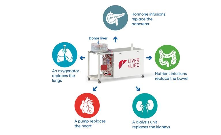 Une machine de perfusion imitant le corps humain (dans le sens des aiguilles d'une montre, depuis le haut): des infusions d'hormones remplacent le pancréas, des infusions de nutriments remplacent l'intestin, une unité de dialyse remplace les reins, une pompe remplace le cœur, un oxygénateur remplace les poumons. [USZ.ch - Liver4Life]