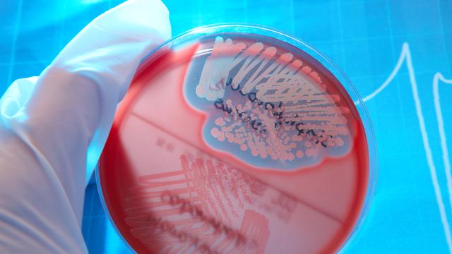 Le staphylocoque doré fait partie des bactéries ayant développé une résistance aux antibiotiques. [Depositphotos - Amaviael]