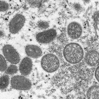 La variole du singe, une maladie qui apparaît rarement en dehors de l'Afrique, a été identifiée ces derniers jours par les autorités sanitaires européennes et américaines. [CDC via AP/KEYSTONE - Cynthia S. Goldsmith, Russell Regner]