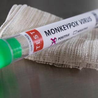 La variole du singe fait beaucoup parler depuis quelques mois. [Reuters - Dado Ruvic]