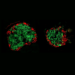 Lorsque le diabète commence à se développer, une partie des cellules bêta du pancréas (en vert) disparaissent (image de droite) en comparaison d’un individu sain (image de gauche). 
Laboratoire du Prof. Pierre Maechler
Unige [Unige - Laboratoire du Prof. Pierre Maechler]