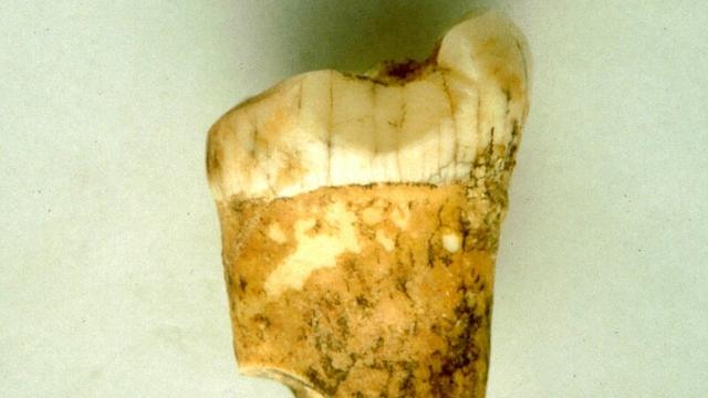 La première molaire d'un homme de Néandertal analysée pour cette étude. 
Lourdes Montes
CNRS [CNRS - Lourdes Montes]