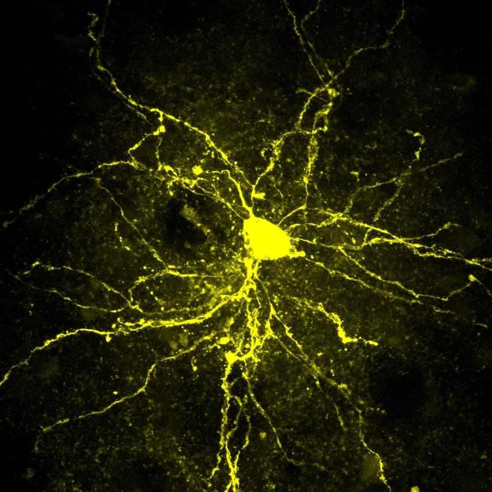 Un neurone "à épine moyenne" (Medium Spiny Neuron). [UNIGE - Camille Bellone]