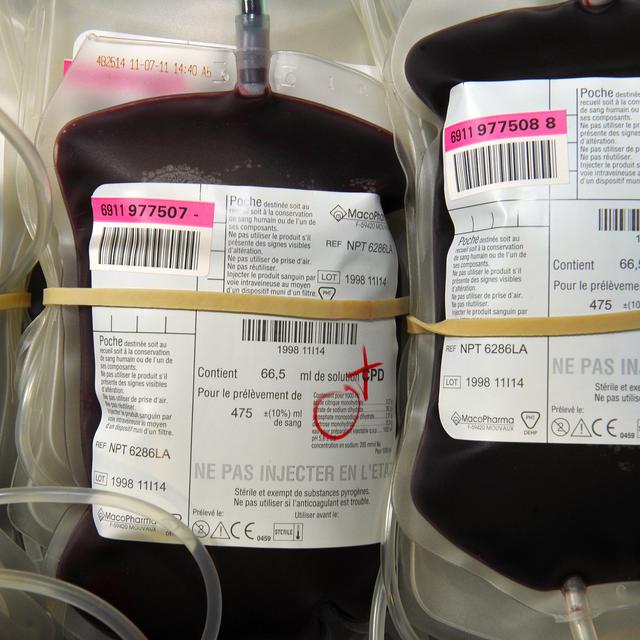 L'affaire du sang contaminé éclate dans plusieurs pays dans les années 1980 et 1990. Des patients sont infectés par le virus du sida ou par l'hépatite C après des transfusions sanguines. [afp]
