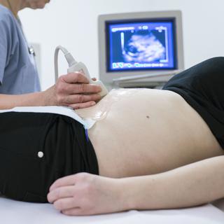 Une femme enceinte observe une échographie. [Keystone - Christian Beutler]