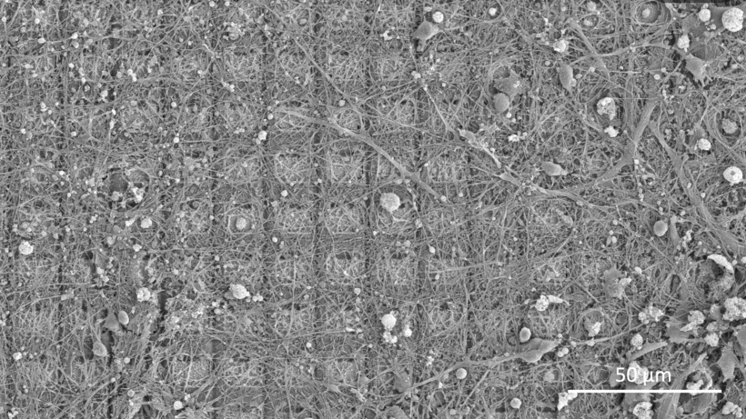 Cette image au microscope électronique à balayage montre une culture de neurones se développant sur un réseau de microélectrodes à haute densité. Ce système a permis à l'équipe de recherche d'entraîner les neurones à jouer au jeu vidéo Pong. [Neuron - Cortical Labs]
