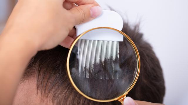 Recherche de lentes et de poux à la loupe et au peigne fin dans les cheveux. [Depositphotos - AndreyPopov]