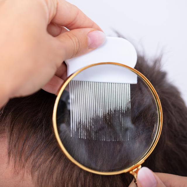 Recherche de lentes et de poux à la loupe et au peigne fin dans les cheveux. [Depositphotos - AndreyPopov]