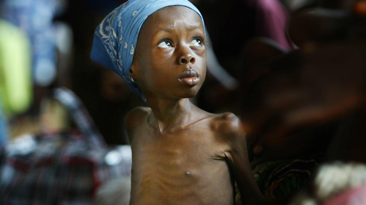 Une personne meurt de faim toutes les 36 secondes entre Ethiopie, Kenya et Somalie. [Keystone]