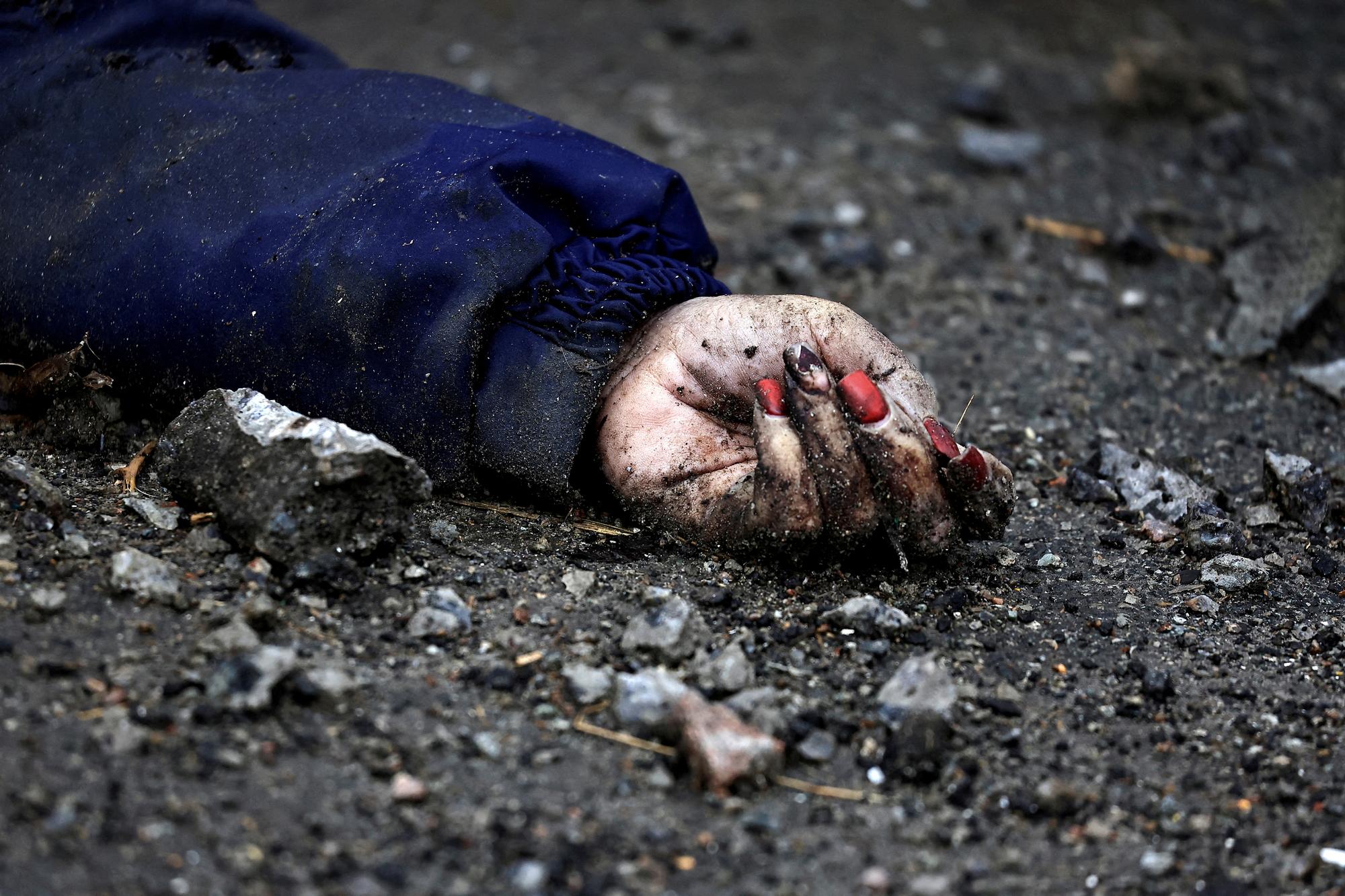 La main d'Iryna Filkina, civile abattue à vélo et laissée dans la rue par les soldats russes à Boutcha. [Reuters - Zohra Bensemra]
