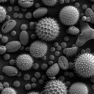 Grains de pollen au microscope électronique. [Domaine public]