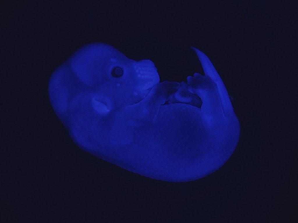 Cet embryon de souris in vivo a été utilisé pour mieux comprendre les mécanismes du développement embryonnaire chez les mammifères et les raisons de certaines malformations (4 nov. 2019). [Labo. de génomique du développement, Denis Duboule/EPFL - Catherine Leutenegger]