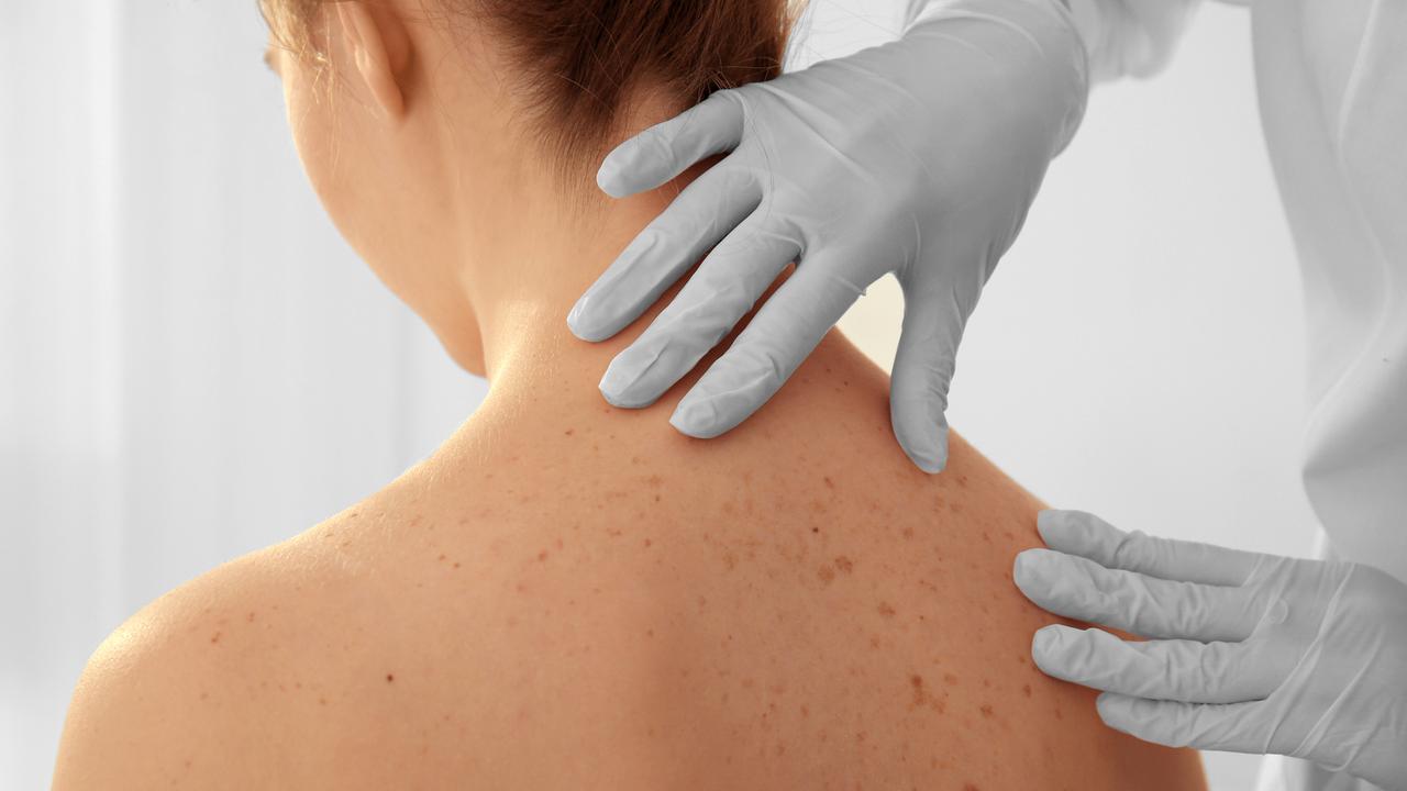 Une patiente se fait examiner par sa dermatologue. En Suisse, les cas de cancers de la peau ont doublé ces 30 dernières années. [Depositphotos - Belchonock]