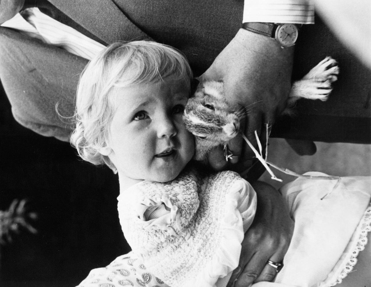Une fillette née avec une malformation due à la thalidomide, en juillet 1963. [Keystone - AP Photo]