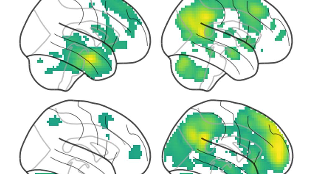 Une équipe de recherche de l'Université de Bâle a décrypté les signaux cérébraux nécessaires à une bonne mémoire. [University of Basel/Nature Communications - Hirnaktivitäten, de Quervain/MCN]