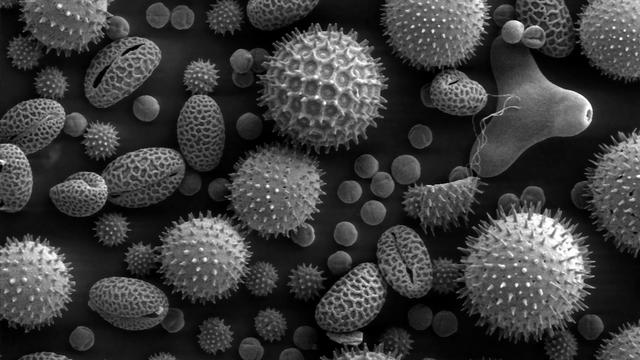Grains de pollen au microscope électronique. [Domaine public]