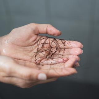 Une chute de cheveux dans les mains d'une femme. [Depositphotos - Cherayut000]