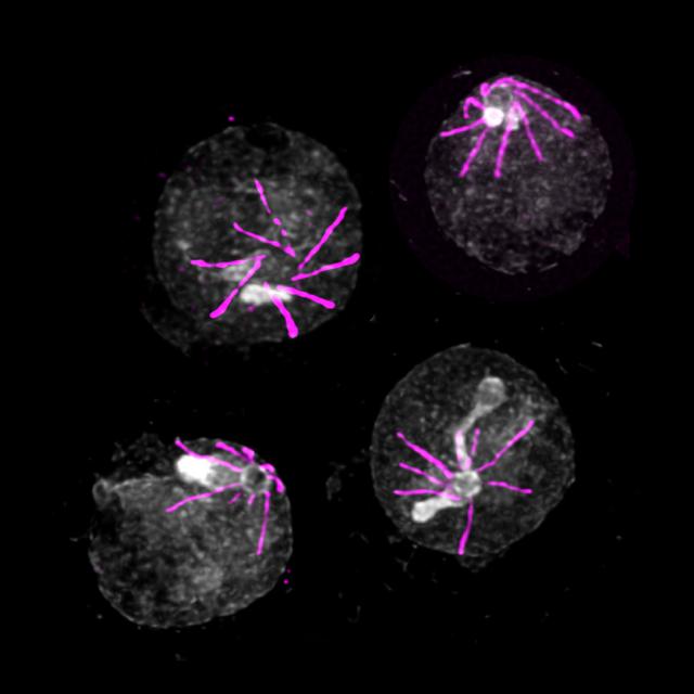 Plasmodium (en rose) responsable de la destruction de globules rouges vue par microscopie à expansion. [©Vincent Louvel et Eloïse Bertiaux]