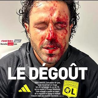 En France, le bus de l’équipe de football de Lyon a été violemment caillassé par des hooligans marseillais